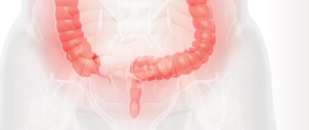 Rectal Cancer: Robotic Technology at the Service of Healing